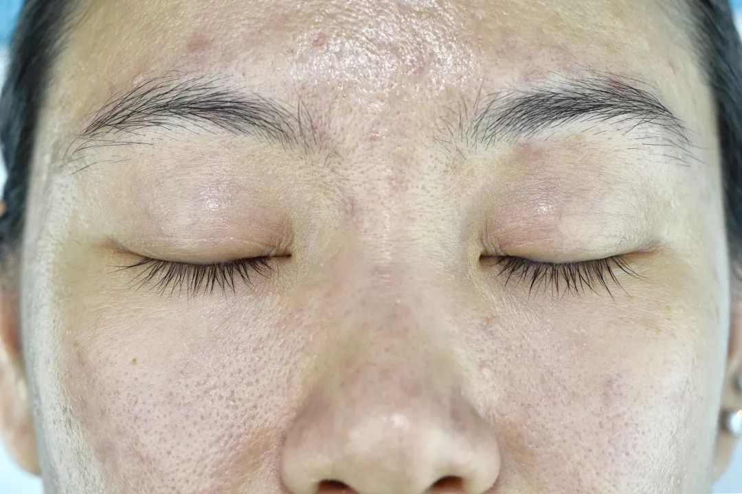18堂面部护肤美颜术：协和医生上万例就诊经验总结，轻松练就细嫩健康肌肤-第7张图片-爱课啦