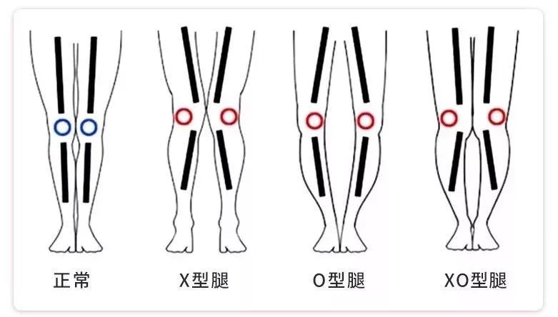 维密私教美腿秘籍：减腿围 · 消肌肉 · 矫正腿型，每天15分钟练出“女神腿”-第28张图片-爱课啦
